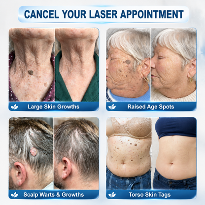 【 🎀Last Day Promotion 70% OFF🎀】🇳🇿𝐇𝐞𝒂𝒍𝗿𝗶𝙯𝙚®2-in-1 Microneedle & Hydrocolloid Patch| Removes Raised Moles, Acne, Flat Warts & Skin Tags | Helps Improve Wrinkles, Scars & Blemishes | Invisible Patches for Face & Body
