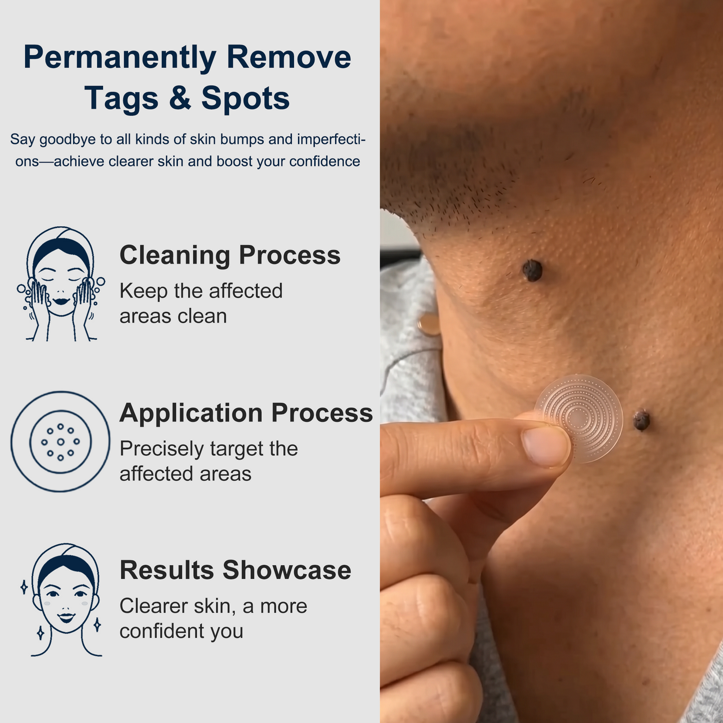 【 🎀Last Day Promotion 70% OFF🎀】🇳🇿𝐇𝐞𝒂𝒍𝗿𝗶𝙯𝙚®2-in-1 Microneedle & Hydrocolloid Patch| Removes Raised Moles, Acne, Flat Warts & Skin Tags | Helps Improve Wrinkles, Scars & Blemishes | Invisible Patches for Face & Body